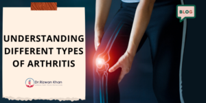 Understanding Different Types of Arthritis